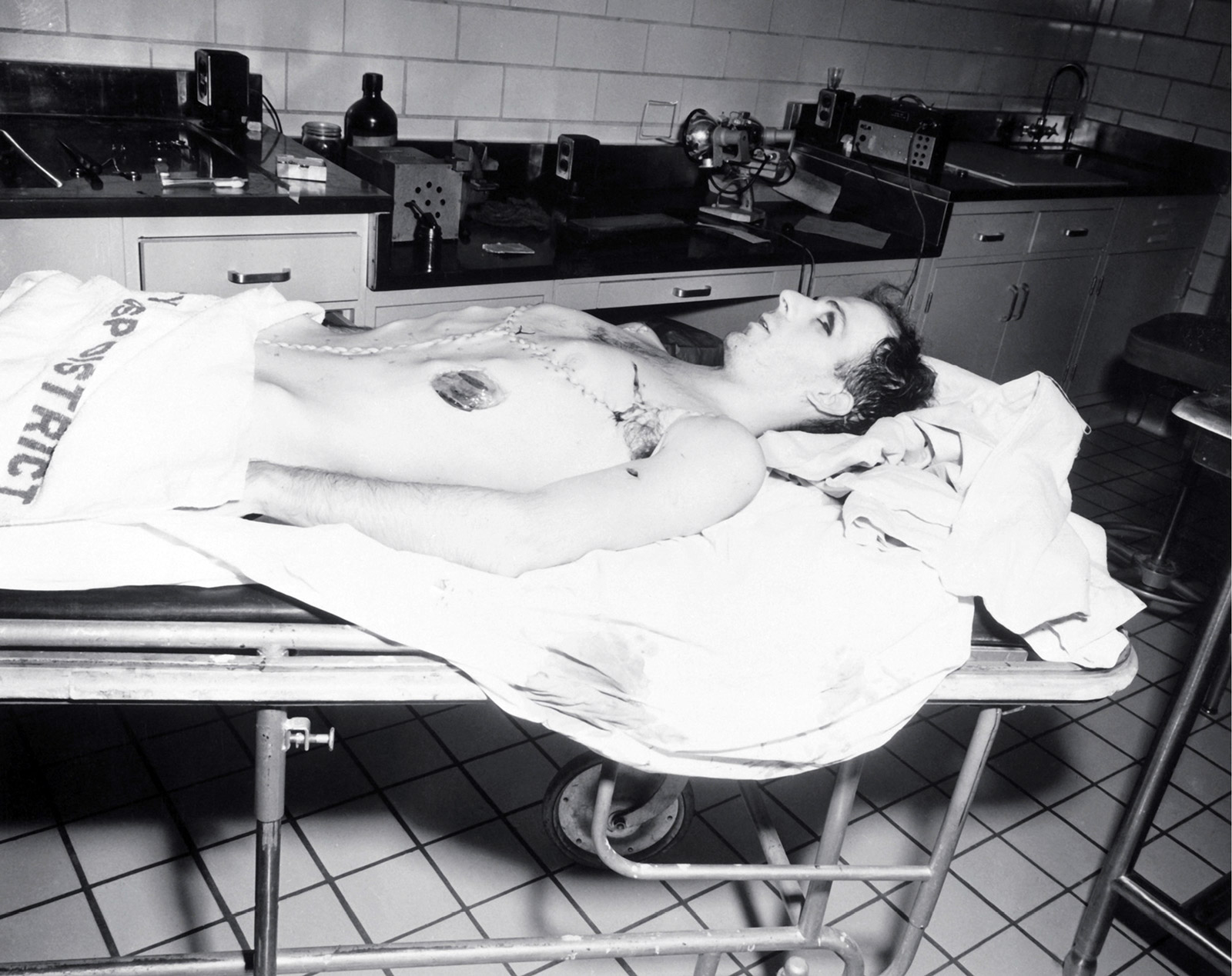 A photograph of Lee Harvey Oswald post-autopsy at Parkland Hospital in Dallas. 