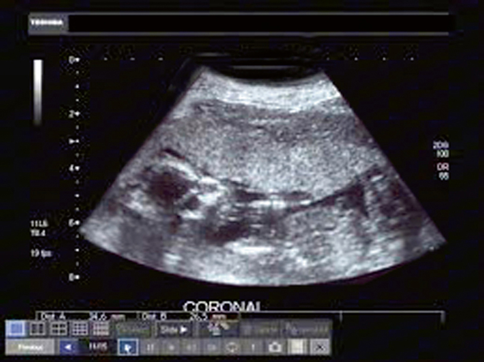 An ultrasound of a baby in the womb.