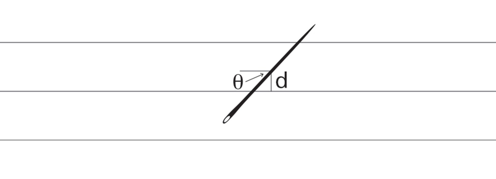 A digital illustration of how to characterize the position of a needle by marking its d and theta values.