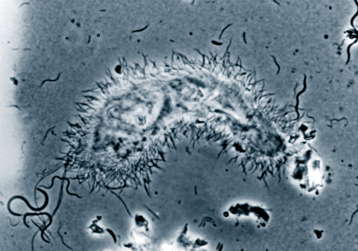 A microscopic photograph of spirochetes attached to a termite gut protozoan.