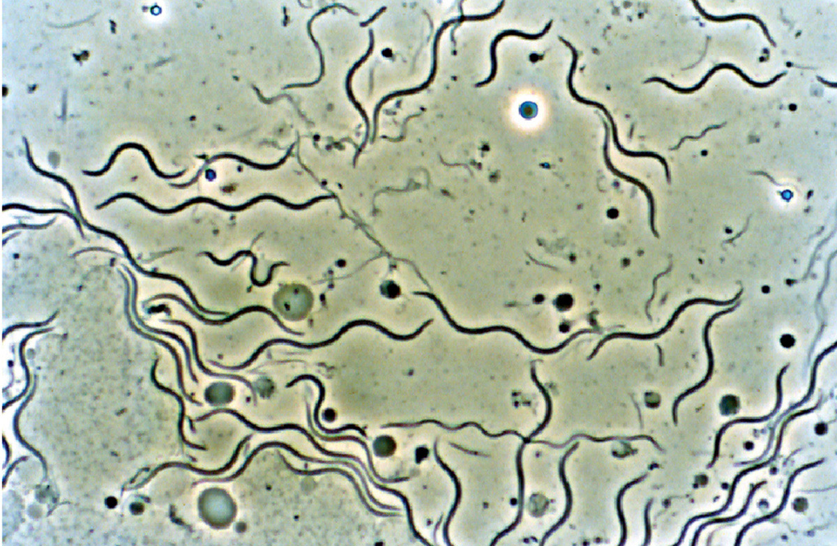 A microscopic photograph of spirochetes from the gut of the dampwood termite Zootermopsis nevadensis. 