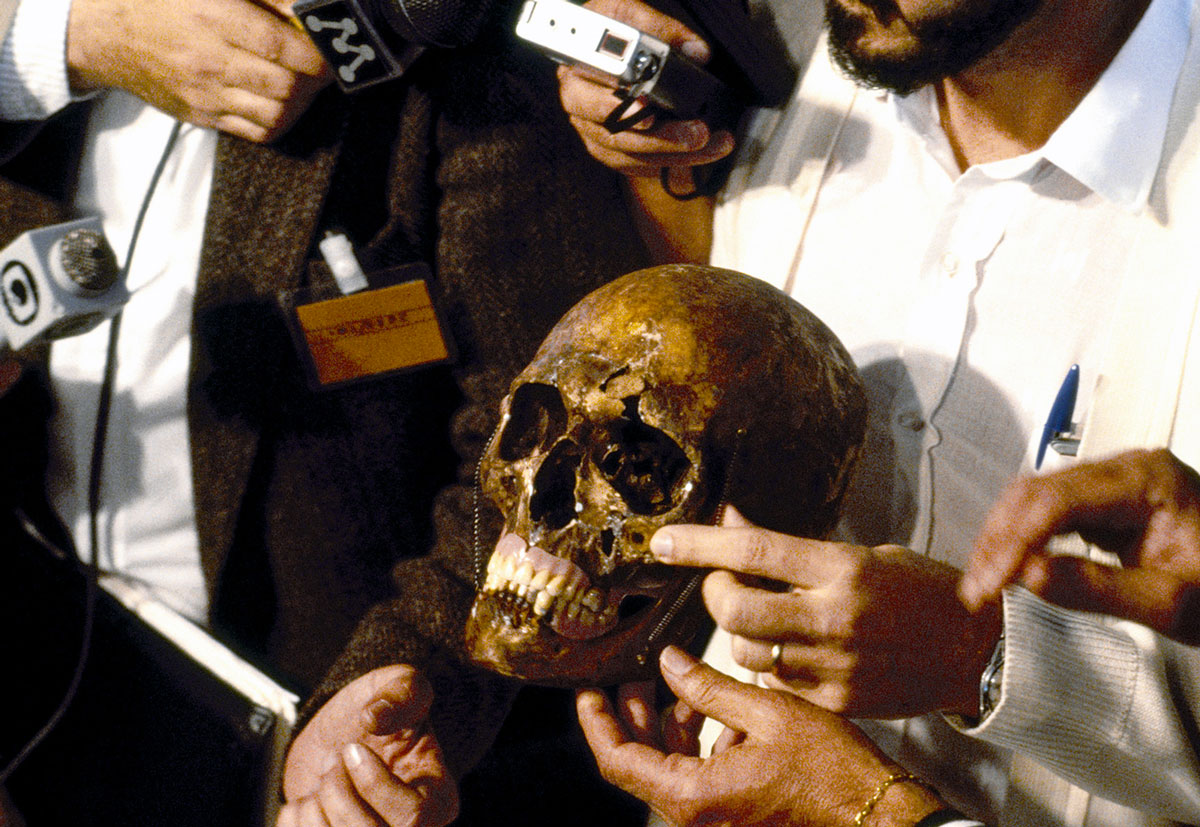 CABINET / Mengele’s Skull