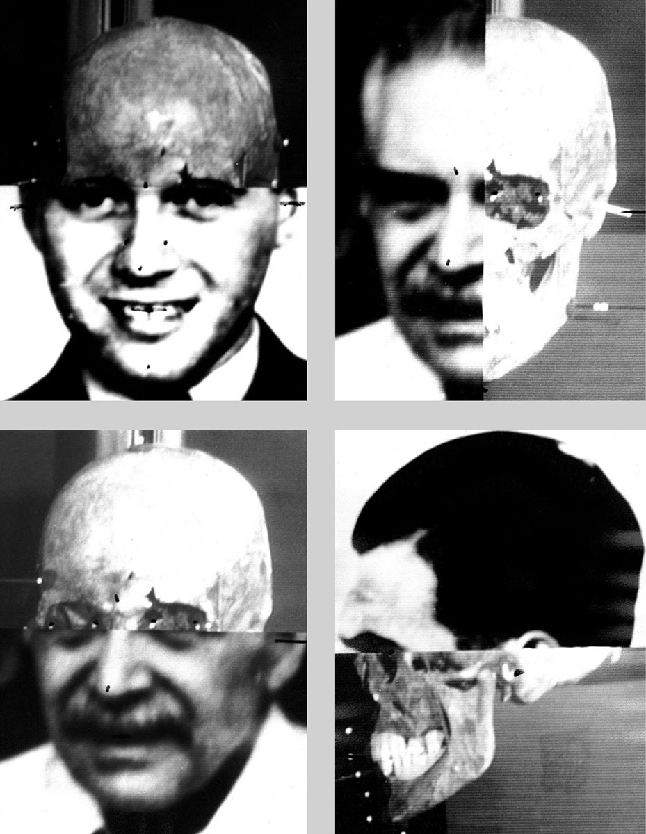 Four of Richard Helmer’s images in which he superimposed photographs of Mengele and the pin-studded skull presumed to be his.