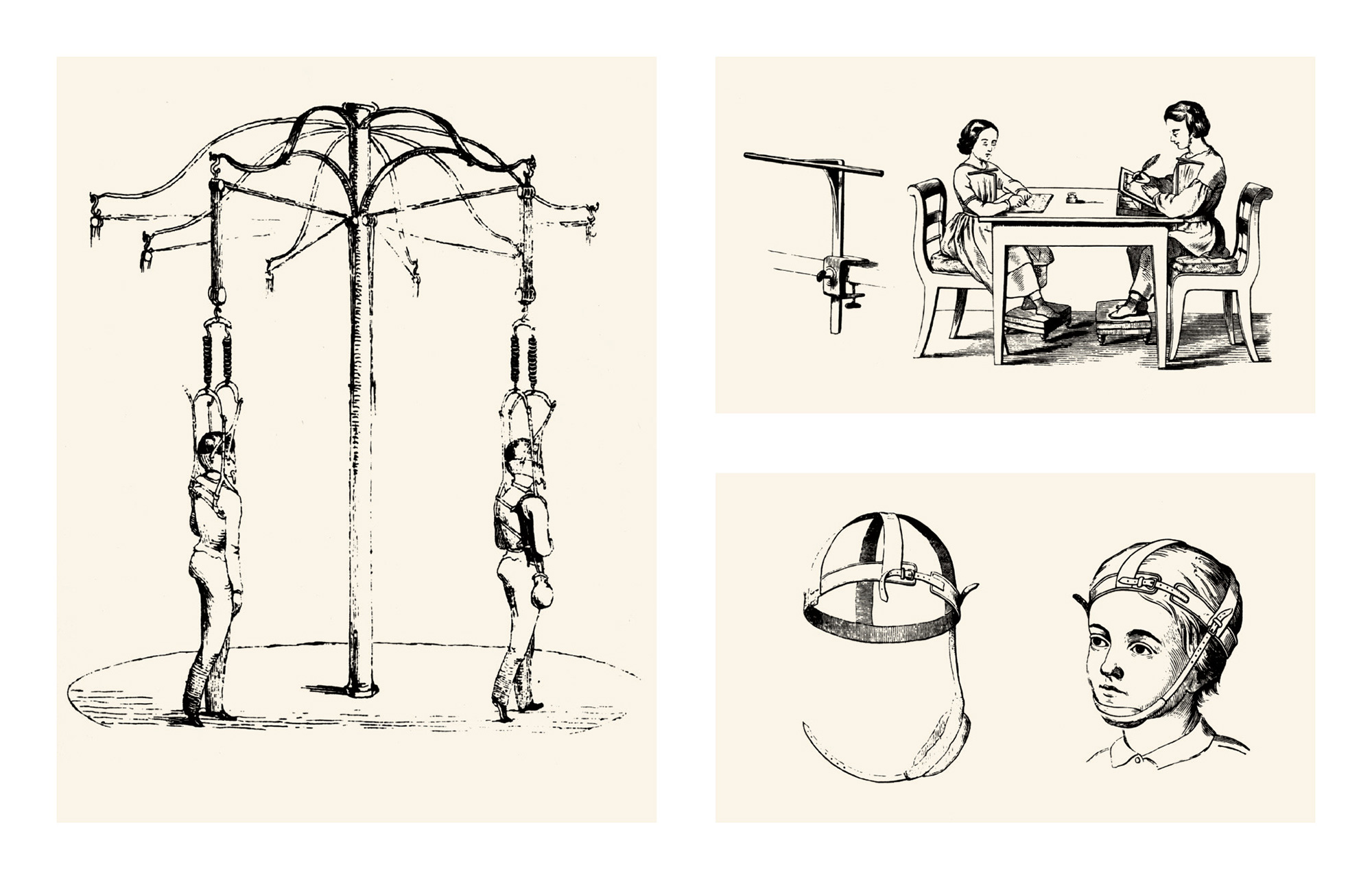 Illustrations of a variety of devices invented by orthopedist Moritz Schreber in the mid-nineteenth century to help produce physically and morally healthy children. Schreber’s son Paul, a lawyer, suffered a spectacular breakdown in later life, and his psychosis was famously analyzed by Freud.
