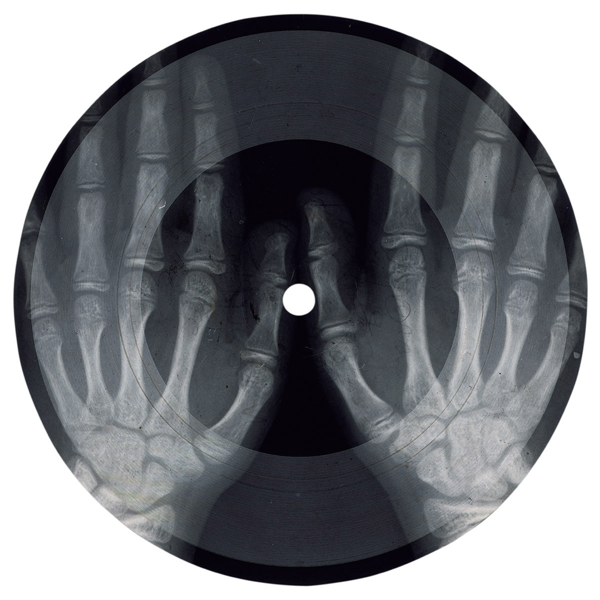 A photograph of a mid twentieth century record fashioned from a discarded X-ray of hands.