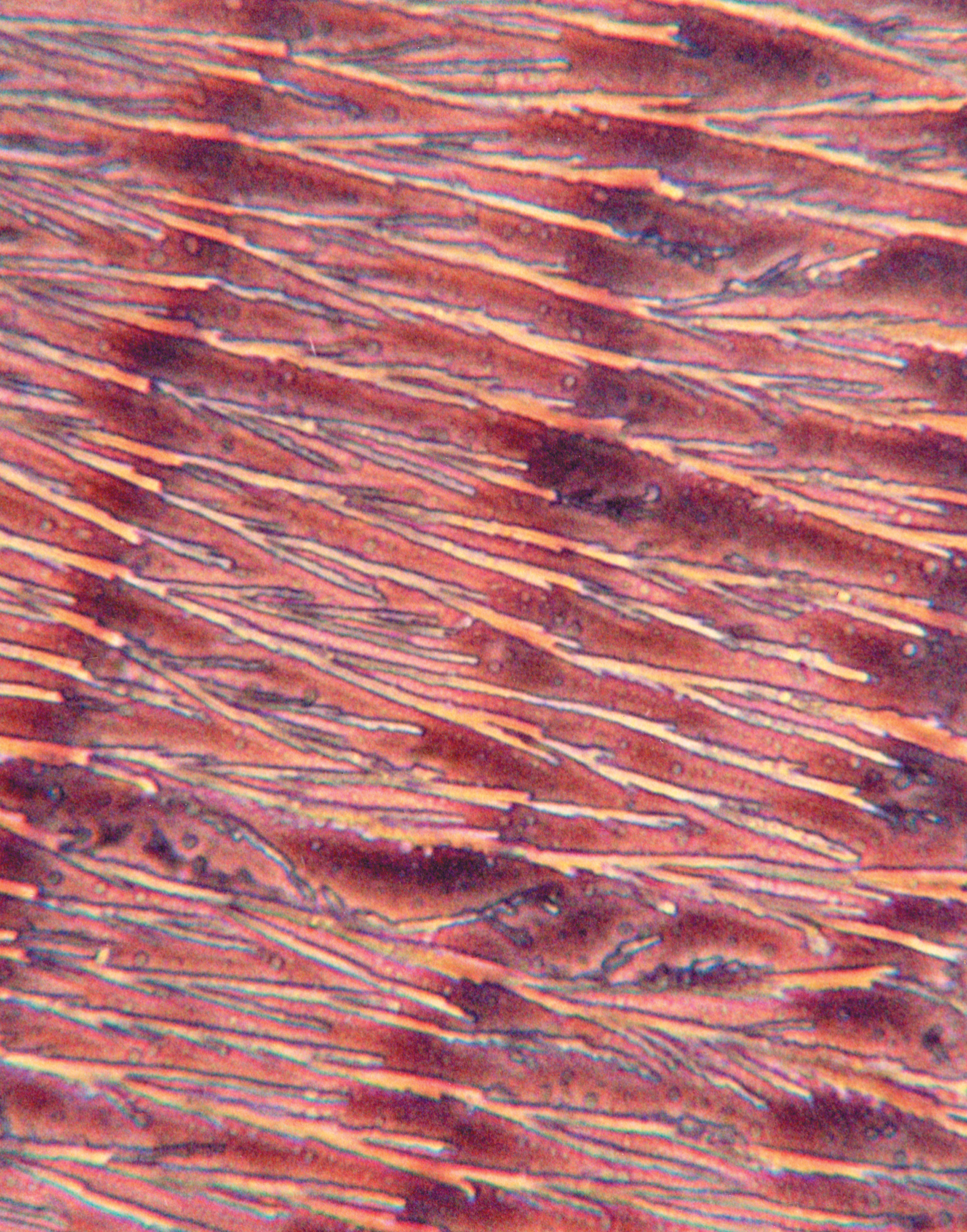 Another microphotograph of prothrombin dried on a glass slide, but in this experiment the linear structure of transmission cables is formed by coating the prothrombin with the biological dialectric hyaluronic acid. The discovery of the electro-active nature of prothrombin and other bio-polymers such as DNA suggests the possibility of a corallary genetic code and a “vascular internet.”
